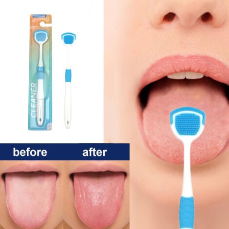 Tongue Cleaner Brush with Soft Silicone Bristles – Oral Hygiene Tool for Fresh Breath &amp; Bacteria Removal -  Tongue Cleaner - Tongue Scraper - Bad Breath Remover - Random Color