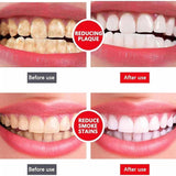 Yayashi Sp 4 Ultra Whitening Toothpaste Strong Stain Removal Fresh Breath Daily Oral Care - 120g