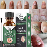 Original Nail Fungus Treatment Stop Fungal Growth Effective Fingernail 10ml