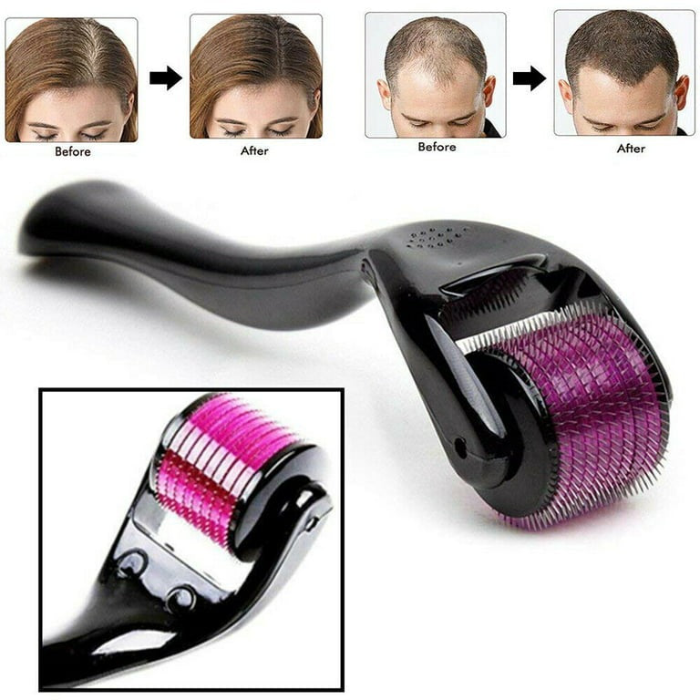 Derma Roller, 0.5mm for Hair and Skin Therap, Micro Needle Derma Roller with 540, Beauty Roller for Anti-aging Skin Repair, Acne Scars Removal and Pores with 540 Titanium Needle for Men and Women