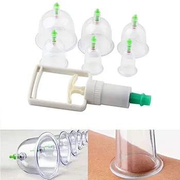 10-Piece Hijama Cupping Therapy Set – Vacuum Suction Massage Cups with Pull-Out Pump | Pain Relief, Blood Circulation, Relaxation & Muscle Recovery Kit