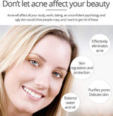 Aichun Beauty Anti - Acne Whitening Facial Serum Aloe Vera Extract Salicylic Acid Repairs Damaged Skin | 30ml