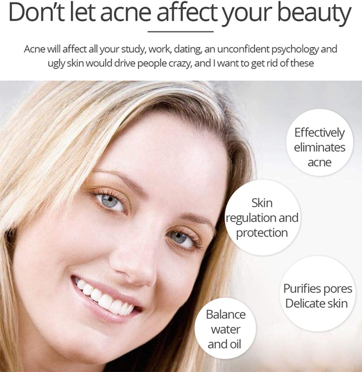 Aichun Beauty Anti - Acne Whitening Facial Serum Aloe Vera Extract Salicylic Acid Repairs Damaged Skin | 30ml