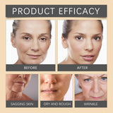 Botox Bee Venom Whitening & Moisturizing Cream – Anti-Aging, Brightening & Skin Firming Facial Care (100g)