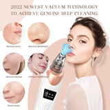 JB- 8826 Beauty Skin Care Expert Acne Pore Cleaner Acne  Beauty skin care specialist 5in1