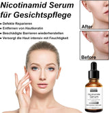 Pretty Cowry Nicotinamide Serum with Vitamin C | 30 ml Nicotinamide Face Serum for Anti-Wrinkles and Age, Even Skin, Against Blemishes and Stains