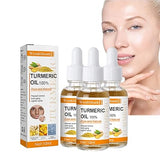 10ml Turmeric Lemon Oil Skin Glow To Lightening Acne Dark Patches, Turmeric Dark Spot Corrector Serum, Turmeric Repair Face Serum, Bright Skin Dark Spot Corrector Face Whitening Serum