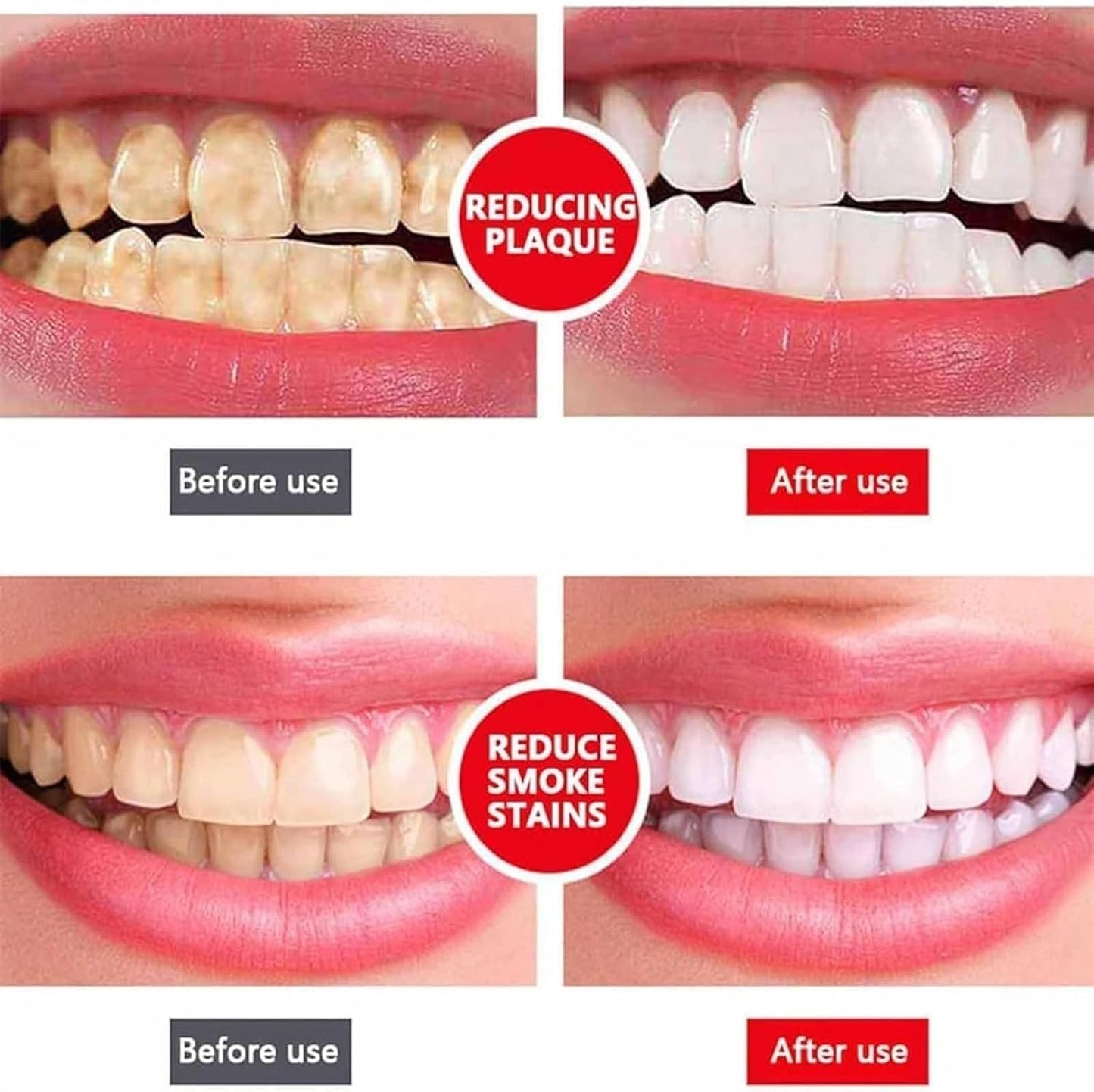 Yayashi  Sp-4 Ultra Whitening Toothpaste Probiotic Stain Remover / Stain Removing Toothpaste, Protects Gums Freshens Breath, for Everyone