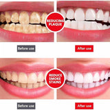 Yayashi Sp-4 Ultra Whitening Toothpaste Probiotic Stain Remover 120Gm / Stain Removing Toothpaste, Protects Gums Freshens Breath, for Everyone
