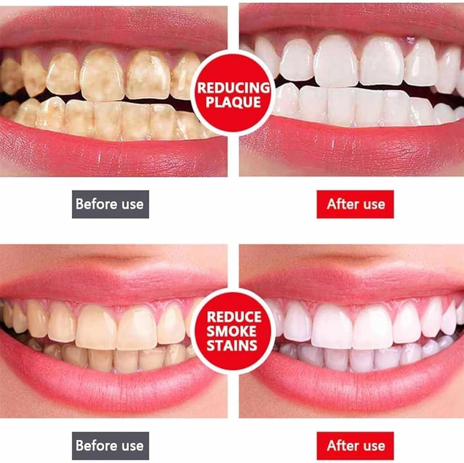 Yayashi Sp-4 Ultra Whitening Toothpaste Probiotic Stain Remover / Stain Removing Toothpaste, Protects Gums Freshens Breath, for Everyone