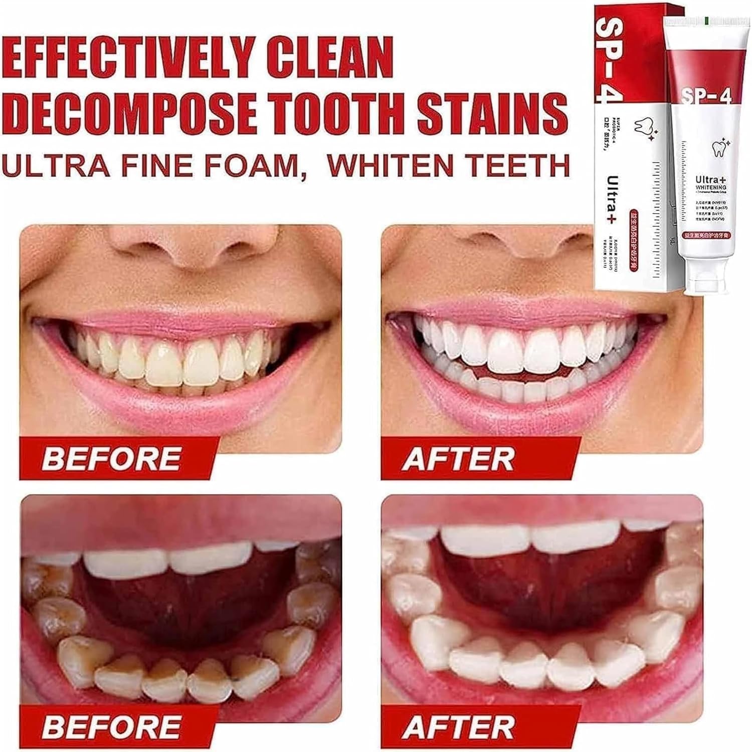 Yayashi Sp-4 Ultra Whitening Toothpaste Probiotic Stain Remover 100ml / Stain Removing Toothpaste, Protects Gums Freshens Breath, for Everyone