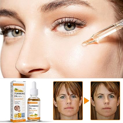 10ml Turmeric Lemon Oil Skin Glow To Lightening Acne Dark Patches, Turmeric Dark Spot Corrector Serum, Turmeric Repair Face Serum, Bright Skin Dark Spot Corrector Face Whitening Serum
