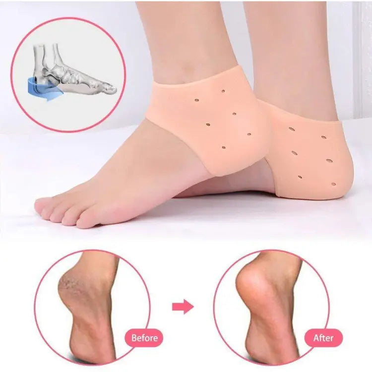 Pack of 2,Pair of half Heel Pain Anti Crack Silicone Set - Anti Crack  For Pain Relief Unisex