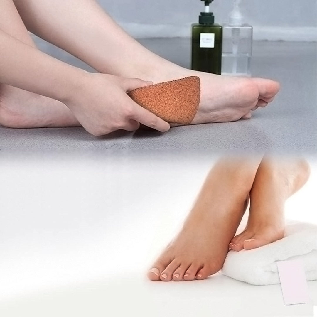 Mud Guru Foot Scrubber, Corn Remover for feet, Dead Skin Remover