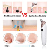 Face Vacuum Suction Blackhead Remover Pore Cleaner | Electric Deep Cleansing Tool for Nose &amp; Face