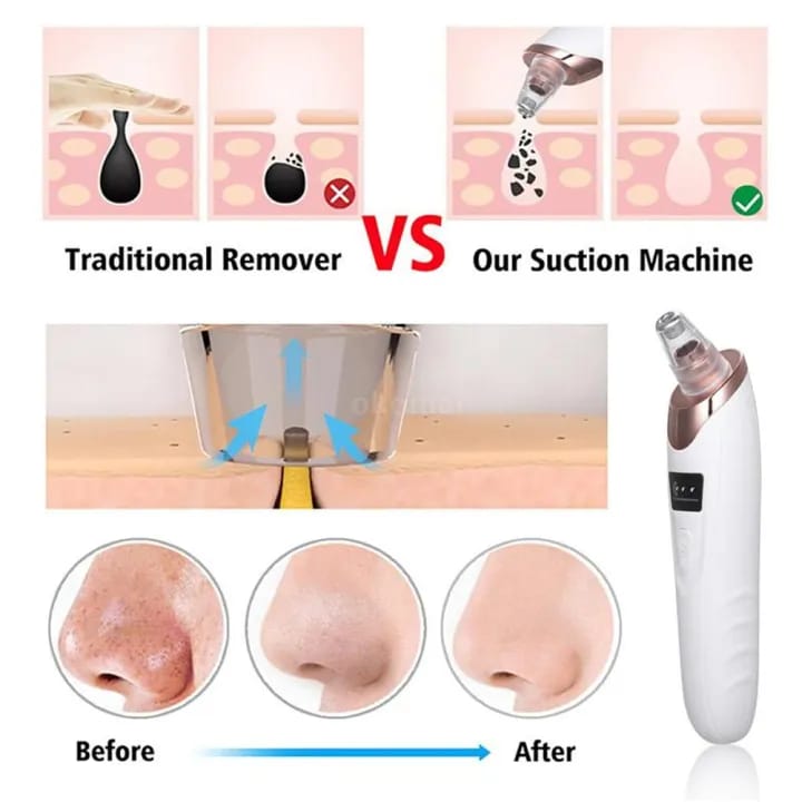 Face Vacuum Suction Blackhead Remover Pore Cleaner | Electric Deep Cleansing Tool for Nose &amp; Face