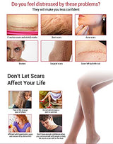 AICHUN BEAUTY Scar Removal Facial Serum Pimples Stretch Marks Face Moisturizing Body Remove Scars Kojic Acid Vitamin E 30ml