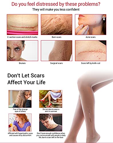 AICHUN BEAUTY Scar Removal Facial Serum Pimples Stretch Marks Face Moisturizing Body Remove Scars Kojic Acid Vitamin E 30ml