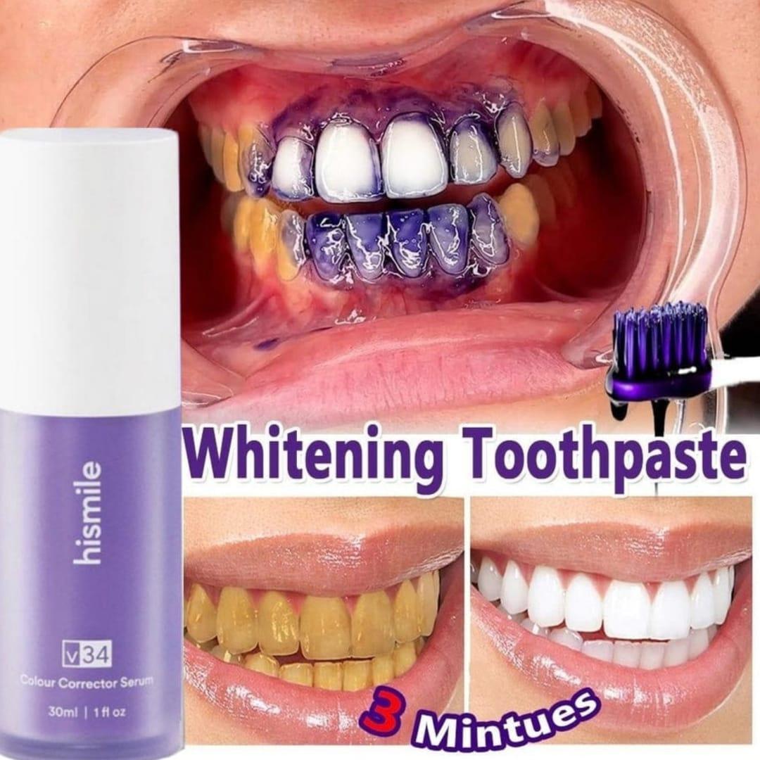Teeth Brightening Hismiles V34 Colour Corrector Serum - 30ml | Best Quality Serum For Teeth Brightening