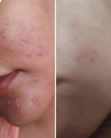 Nirvana Botanics- Vitamin C &amp; E Serum 15ml