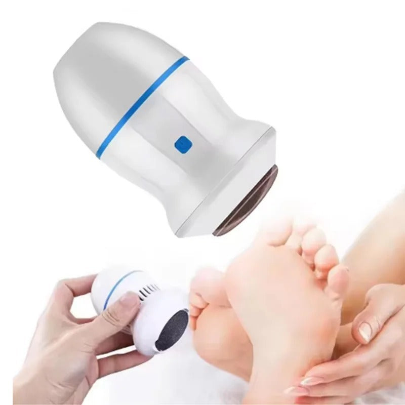 Back Callus Remover with Built-In Vacuum – Electric Foot Grinder for Dead Skin, Cracked Heels &amp; Calluses, Rechargeable Pedicure Tool with Gentle &amp; Powerful Exfoliation