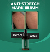 Markaway Advanced Stretch Mark Serum – Clinic-Tested Formula for Prevention & Fading | Retinol, Hydroquinone, & AHA/BHA-Free