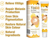 Bee Venom Vitiligo Treatment Cream - Restore Melanocytes & Skin Pigmentation - Natural Melanin Care Ointment for Leukoplakia (20g)