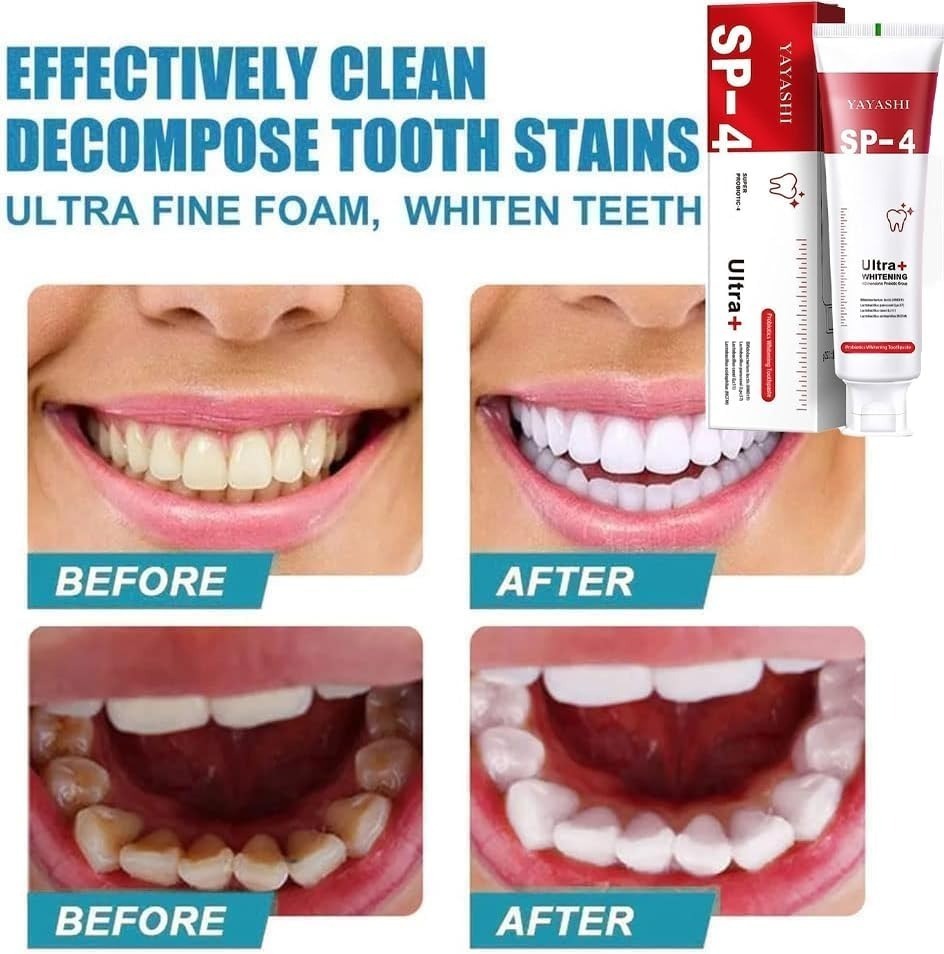 Yayashi SP-4 Ultra Whitening Toothpaste – 150ml Probiotic Stain Remover for Bright, Healthy Teeth