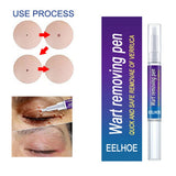 Warts Remover Original Cream Wart Removal Ointment Wart Treatment Skin Tag Mole Remover Antibacterial Foot Wart