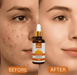 Relax Vitamin C Daily Face Serum – Brightening, Anti-Aging & Hydrating Formula for Healthy Radiant Skin (30ml)
