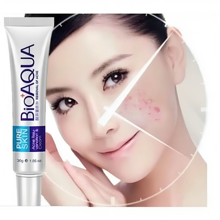 BIOAQUA Pure Skin Acne Removal & Anti-Wrinkle Cream – Fast Action Formula for Pimples, Scars, Fine Lines & Smooth Clear Skin (30g)