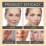 Bee Venom Botox Face Cream – Whitening, Anti-Aging & Deep Moisturizing Skincare for Bright, Smooth & Hydrated Skin