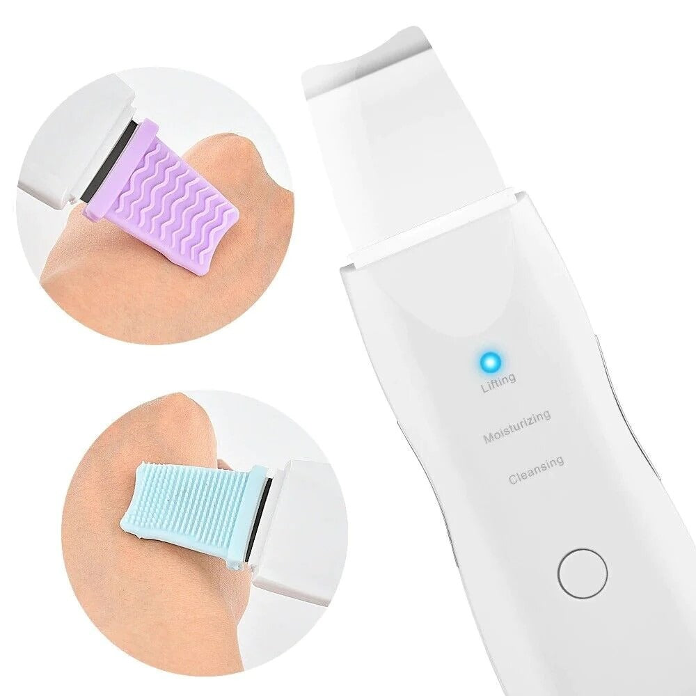 Rechargeable Ultrasonic Skin Scrubber – Deep Cleansing Facial Spatula &amp; Blackhead Remover with Vibration &amp; Peeling Modes