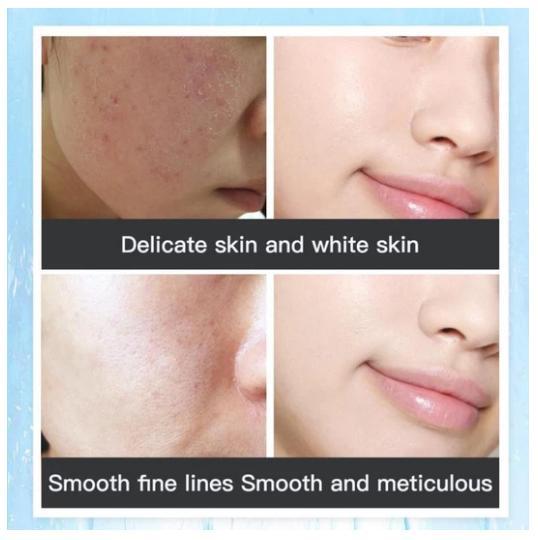 2021 New Style Black Rose Seed Seaweed Full Face Mask Moisturizing Granules 1 piece  mkfrbnu1d-2