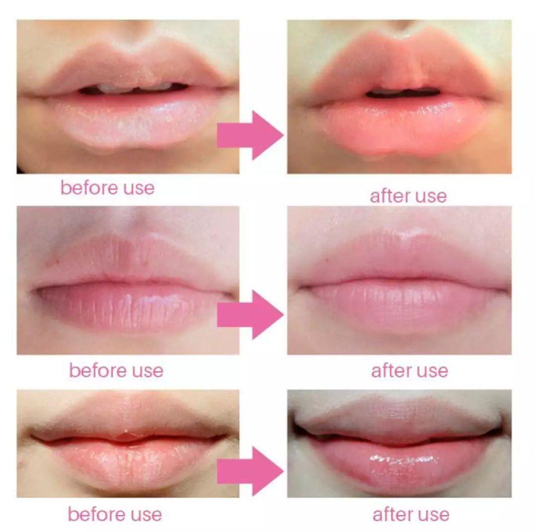 YMS Magic Lip Chapet - Magic Lip Oil Pink lips  mlomiz6c-e