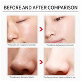2021 New Style Black Rose Seed Seaweed Full Face Mask Moisturizing Granules 1 piece  mkfrbnu1d-2