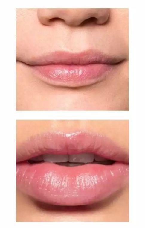 YMS Magic Lip Chapet - Magic Lip Oil Pink lips  mlomiz6c-e